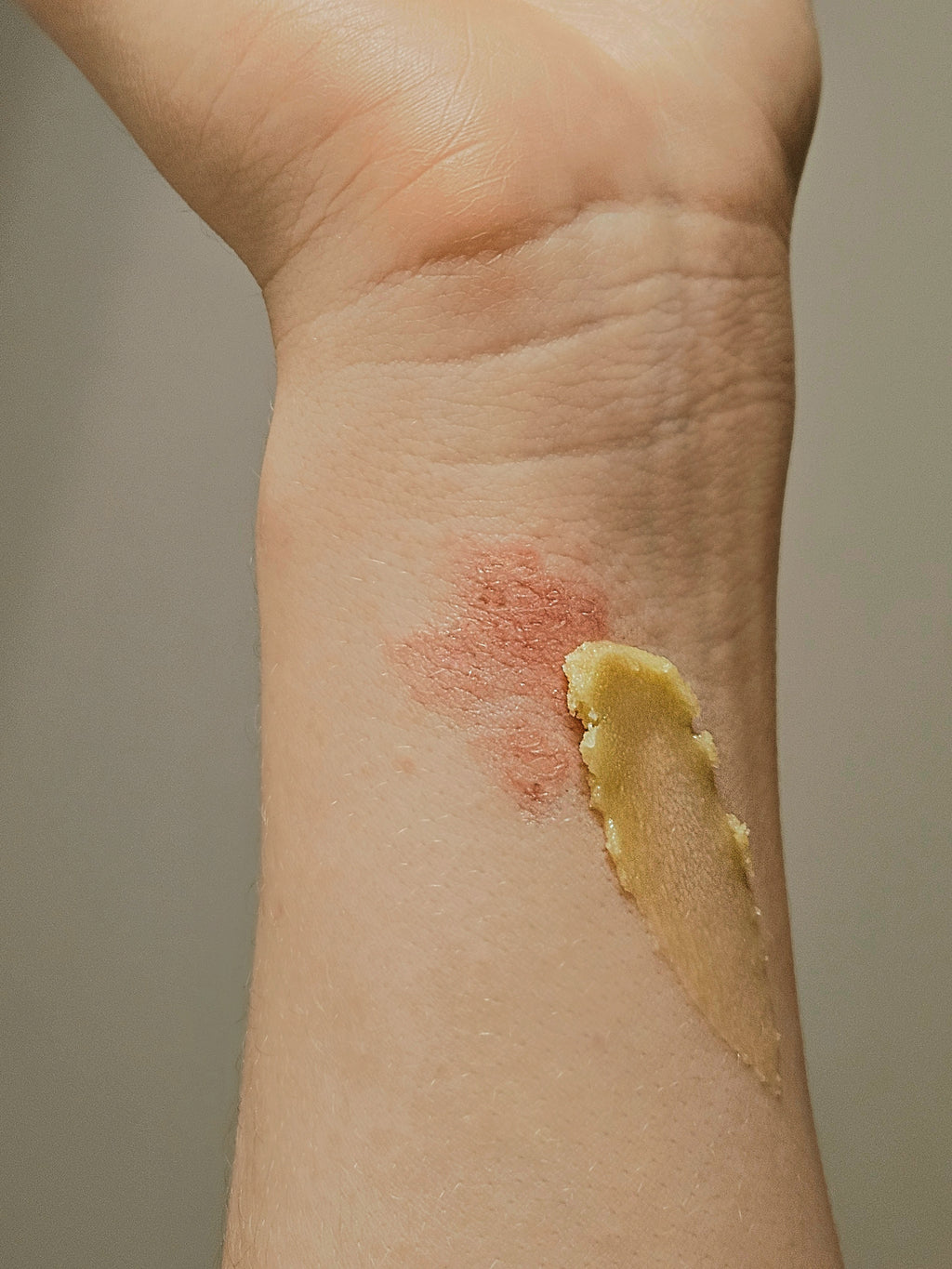 Overnight Healing Balm