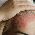 Overnight Healing Balm