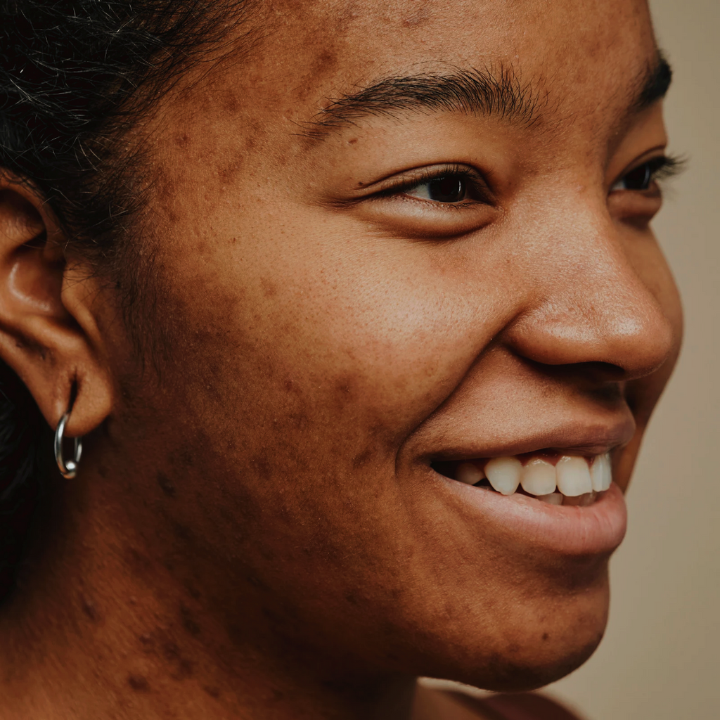 Oily & Acne Prone Skincare Trial Set